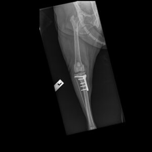 x-ray of dog leg with plate and pins